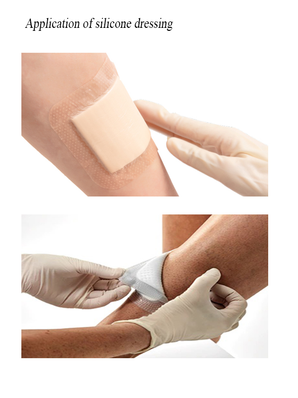 Silicone wound dressing polyurethane foam with soft silicone dressing