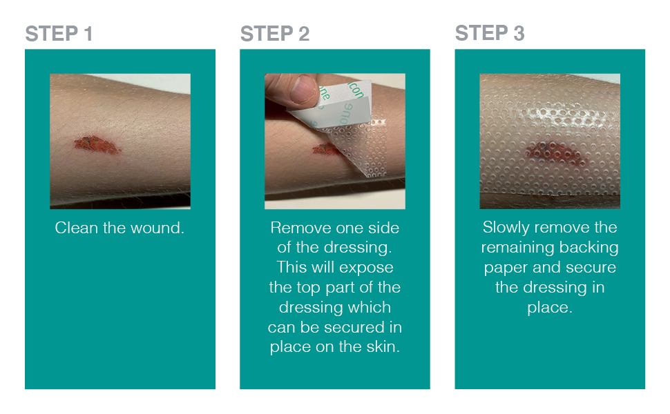 Adaptic silicone dressing non adherent silicone layer dressing