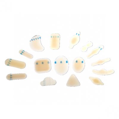 Hydrocolloid Dressing