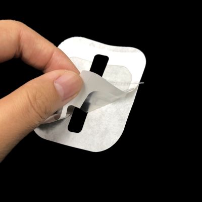 Wound Skin Closure