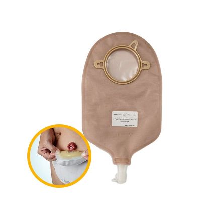 Ostomy Care